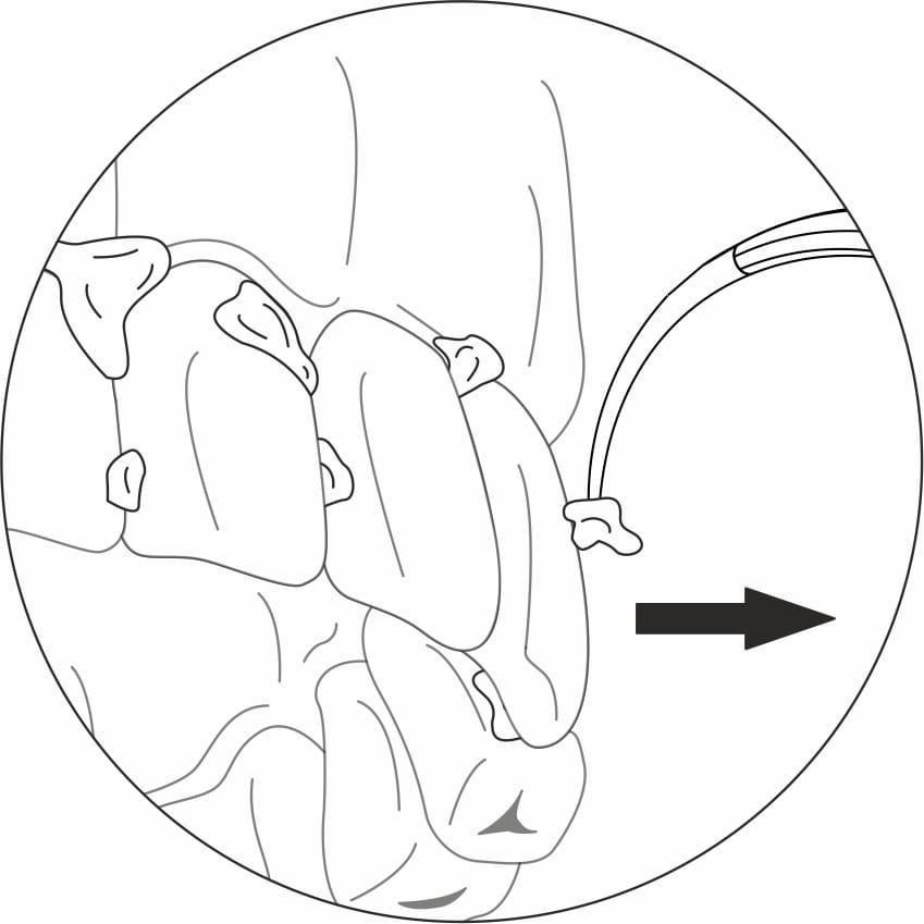 User-Friendly Approach