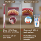 My1Brush Family Pack (4 Brushes) + Free Tongue Cleaner | Super Saver Pack